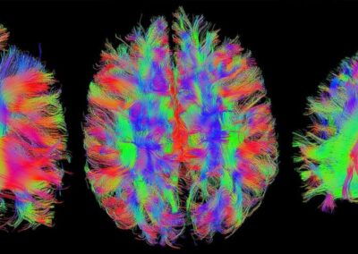 Imagebroschüre | Werner Siemens Imaging Center